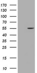 MYBPH Antibody in Western Blot (WB)