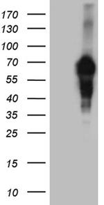 MYCN Antibody in Western Blot (WB)