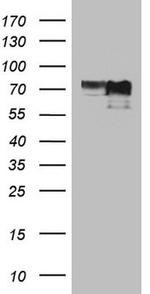 MYCN Antibody in Western Blot (WB)