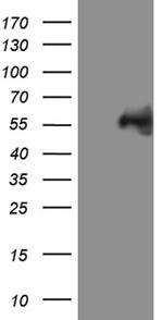 MYCN Antibody in Western Blot (WB)