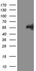 MYCN Antibody in Western Blot (WB)