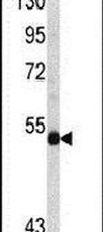 n-Myc Antibody in Western Blot (WB)