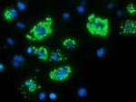 MYD88 Antibody in Immunocytochemistry (ICC/IF)