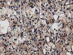MYD88 Antibody in Immunohistochemistry (Paraffin) (IHC (P))
