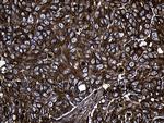MYL1 Antibody in Immunohistochemistry (Paraffin) (IHC (P))