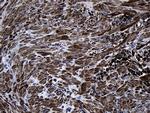 MYL1 Antibody in Immunohistochemistry (Paraffin) (IHC (P))