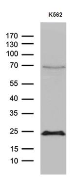 MYL1 Antibody in Western Blot (WB)
