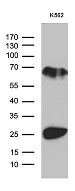 MYL1 Antibody in Western Blot (WB)