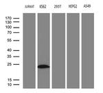 MYL1 Antibody in Western Blot (WB)