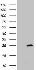 MYL4 Antibody in Western Blot (WB)