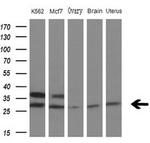 MYL4 Antibody in Western Blot (WB)