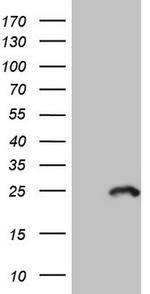 MYL4 Antibody in Western Blot (WB)