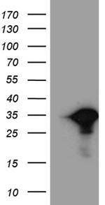 MYL6B Antibody in Western Blot (WB)