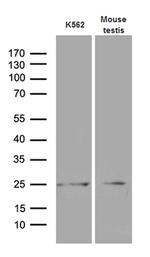 MYL6B Antibody in Western Blot (WB)