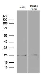 MYL6B Antibody in Western Blot (WB)