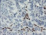 MYL7 Antibody in Immunohistochemistry (Paraffin) (IHC (P))