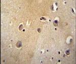 MYLIP Antibody in Immunohistochemistry (IHC)