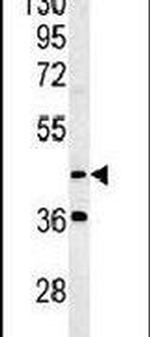 MYLIP Antibody in Western Blot (WB)