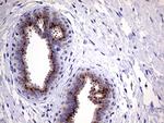 MYOT Antibody in Immunohistochemistry (Paraffin) (IHC (P))