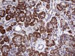 MYOT Antibody in Immunohistochemistry (Paraffin) (IHC (P))