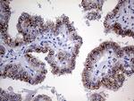 MYOT Antibody in Immunohistochemistry (Paraffin) (IHC (P))