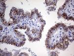 MYOT Antibody in Immunohistochemistry (Paraffin) (IHC (P))