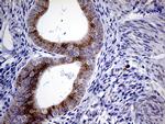 MYOT Antibody in Immunohistochemistry (Paraffin) (IHC (P))