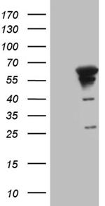 MYOT Antibody in Western Blot (WB)
