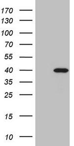 MYOZ1 Antibody in Western Blot (WB)