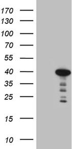 MYOZ1 Antibody in Western Blot (WB)