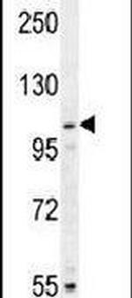 MYSM1 Antibody in Western Blot (WB)