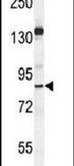 MYSM1 Antibody in Western Blot (WB)