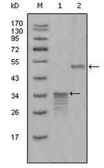 Mammaglobin A Monoclonal Antibody (1G8D6,2E7G9)