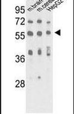 MECP2 Antibody in Western Blot (WB)