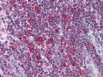 Metadherin Antibody in Immunohistochemistry (Paraffin) (IHC (P))