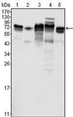 Metadherin Antibody in Western Blot (WB)