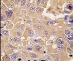 METAP2 Antibody in Immunohistochemistry (IHC)