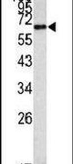 METAP2 Antibody in Western Blot (WB)