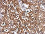 Kindlin 2 Antibody in Immunohistochemistry (IHC)