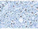 LMP-1 (Epstein-Barr Virus) Monoclonal Antibody (CS1, CS2, CS3, CS4)