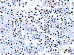 Herpesvirus 8 Monoclonal Antibody (LN53)