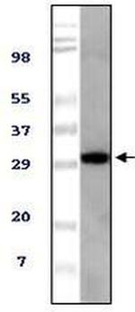 Tug Monoclonal Antibody (4A11A6G11)
