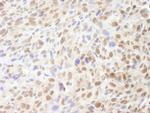 Mre11 Antibody in Immunohistochemistry (IHC)