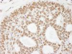 Mre11 Antibody in Immunohistochemistry (IHC)
