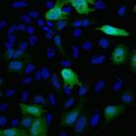 Myc Tag Antibody in Immunocytochemistry (ICC/IF)