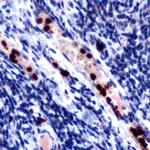 Myeloperoxidase Antibody in Immunohistochemistry (IHC)