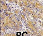 MYO1C Antibody in Immunohistochemistry (IHC)