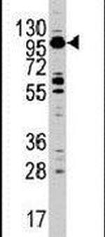 MYO1C Antibody in Western Blot (WB)