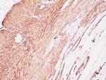Myosin, SMHC Antibody in Immunohistochemistry (Paraffin) (IHC (P))