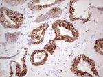 N4BP2L2 Antibody in Immunohistochemistry (Paraffin) (IHC (P))